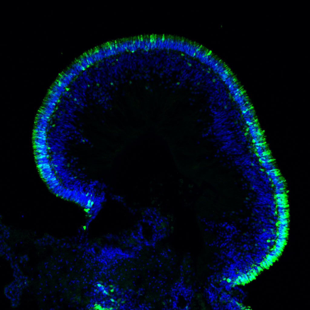Fluorescence micrograph of a patient-derived retinal organoid, showing layers of cells in blue and green.